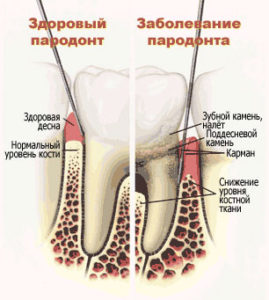 пародонтологія